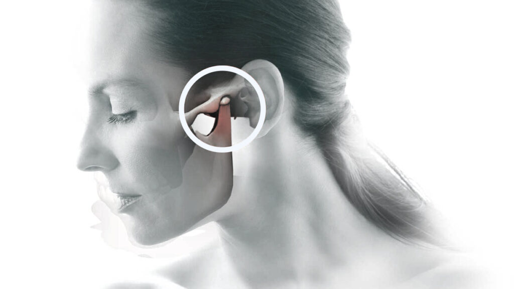 tratamento-dor-atm-bruxismo